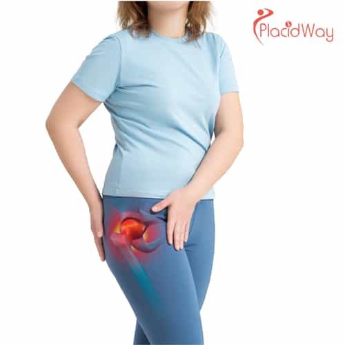 5 Benefits of Hip Replacement Surgery in Warsaw, Poland